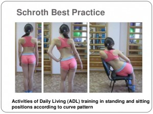 corrective-exercises-in-the-treatment-of-scoliosis-5-638